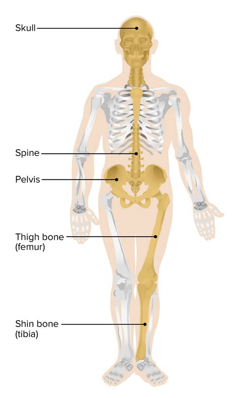 Enfermedad Ósea de Paget | Concise Medical Knowledge