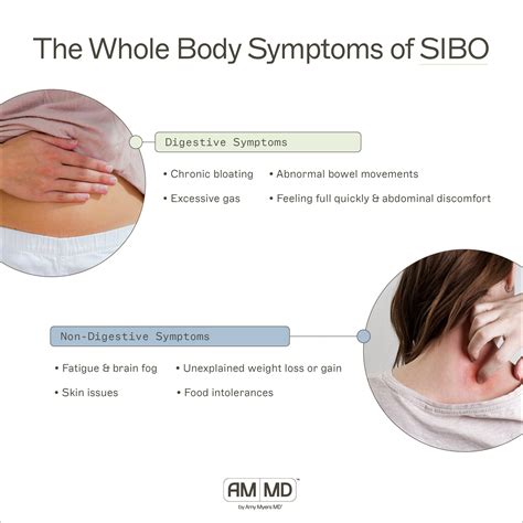 How Do I Know If I Have SIBO? – Amy Myers MD – AMMD