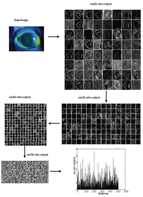 Detection of Corneal Ulcer Using a Genetic Algorithm-Based Image ...