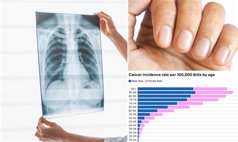 The little-known change to your FINGERTIPS that's an early warning sign ...