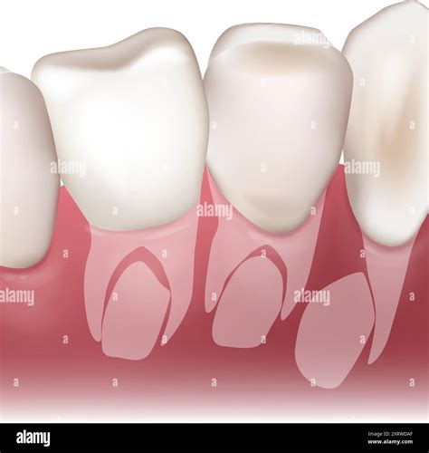 Growth of permanent teeth. Baby teeth or milk tooth. Anatomical ...