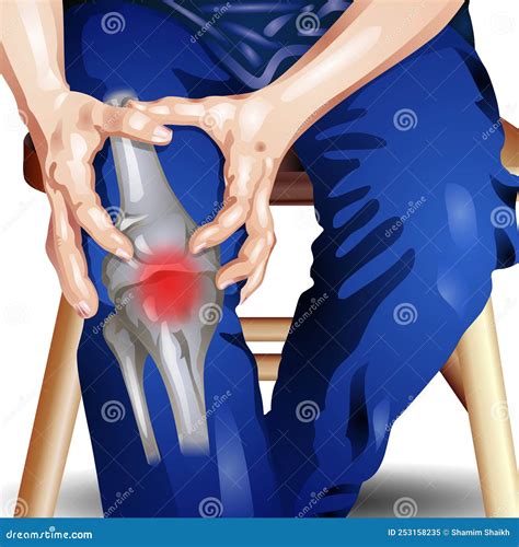 Arthritis Burning Knee Pain at Mildred Rohe blog