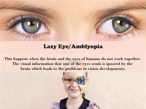 Image result for Types of Vision Problems