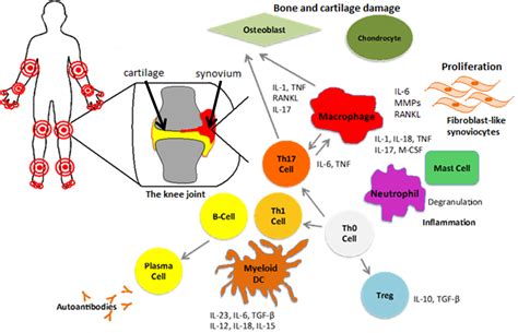 Rheumatoid Arthritis | British Society for Immunology