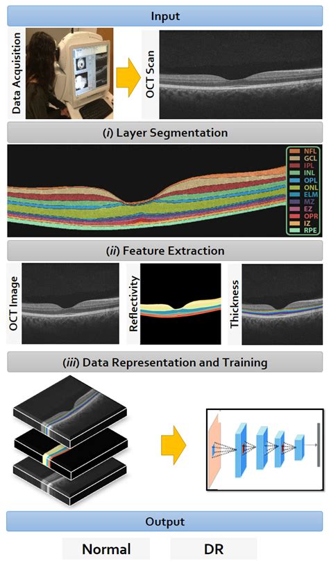A Computer-Aided Diagnostic System for Diabetic Retinopathy Based on Local and Global Extracted ...
