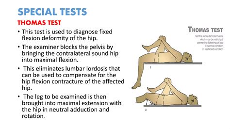 Clinical examination of hip | PPTX
