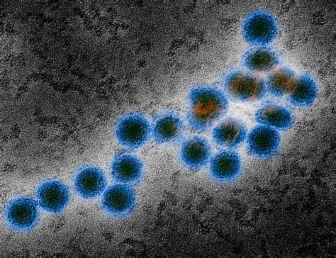 West Nile Virus Symptoms