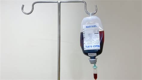 Intravenous Iron Therapy Appears Optimal in Iron Deficiency Anemia With IBD | Docwire News