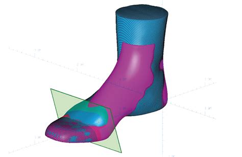 Software for orthopedic shoes production - Shoemaster® Software