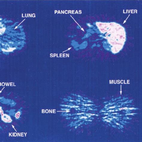 Tissue Distribution 的图像结果