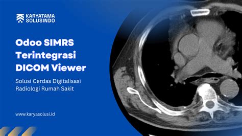 Odoo SIMRS Terintegrasi DICOM Viewer - Karyatama Solusindo