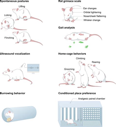 Spontaneous pain as a challenge of research and managemen...