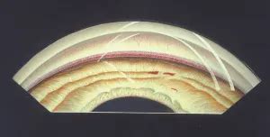 Angle Recession 的图像结果