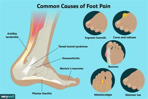 Aging Feet: Chronic Foot Pain In Older People - Feisty Side of 50