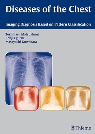 Buy Diseases of the Chest: Imaging Diagnosis Based on Pattern ...
