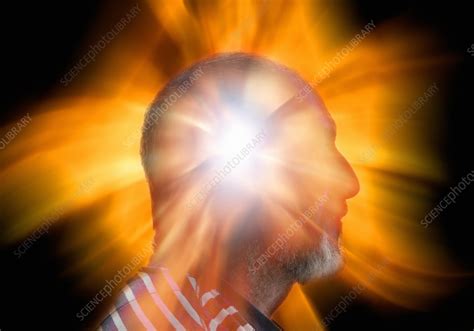 Image result for Exploding Head Syndrome Documentary