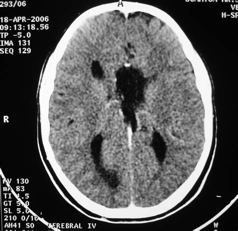 Image result for Scanner Cerebral Avec Injection Diode
