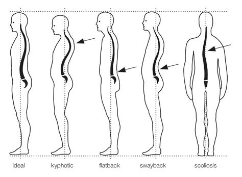 Different Types of Posture 的图像结果