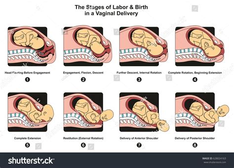 Stages Labor Birth Vaginal Delivery Infographic Stock Vector (Royalty ...