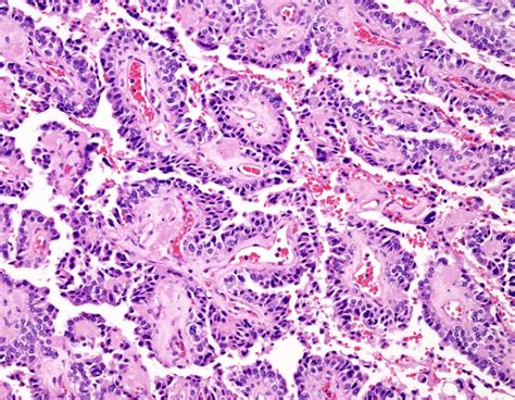 FRCPath Part 1 DEMO (Free)