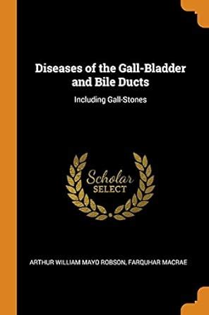 Buy Diseases of the Gall-Bladder and Bile Ducts: Including Gall-Stones ...