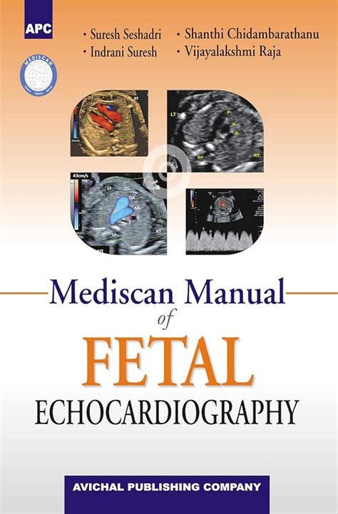 Buy Mediscan Manual of Fetal Ecocardiography Book Online at Low Prices ...