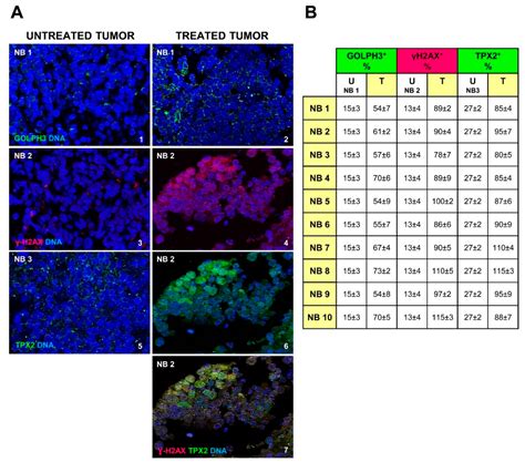 Role of GOLPH3 and TPX2 in Neuroblastoma DNA Damage Response and Cell ...