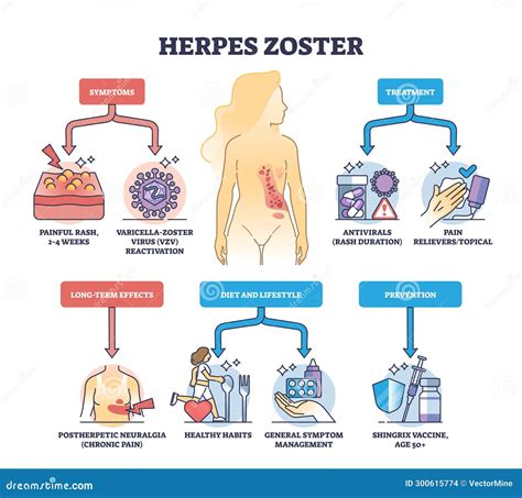 Treatment For Zoster