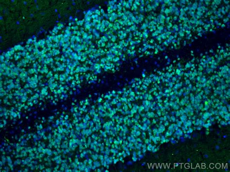 Calretinin antibody (66496-1-Ig) | Proteintech