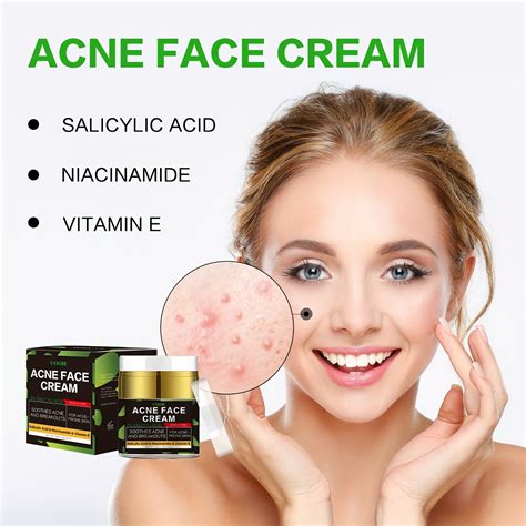 Acne Cream with Niacinamide & Salicylic Acid – CRAZE