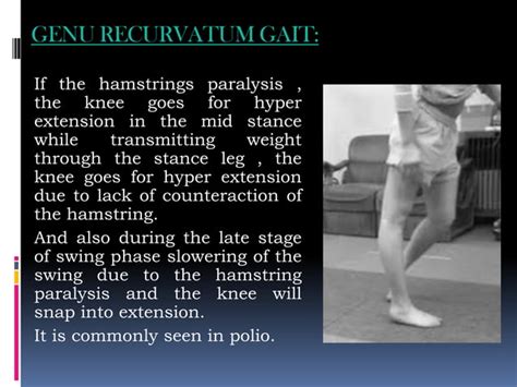 Image result for Contralateral Gait