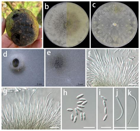 Taxonomy and Multigene Phylogeny of Diaporthales in Guizhou Province, China