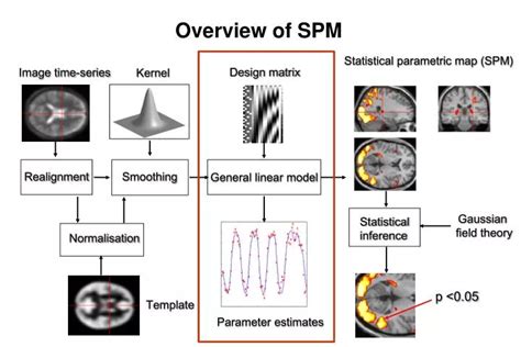 Image result for SPM Tutorial