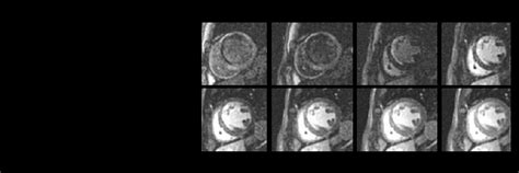Cine IR | GE HealthCare (India)