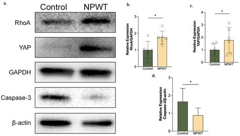 Continuous NPWT Regulates Fibrosis in Murine Diabetic Wound Healing