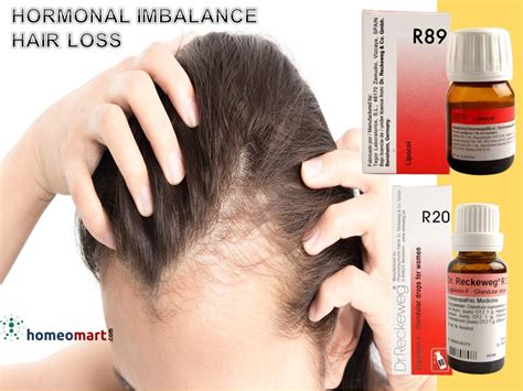 Buy Dr. Reckeweg R89 Hair Drops - Homeopathic Remedy for Hair Loss ...