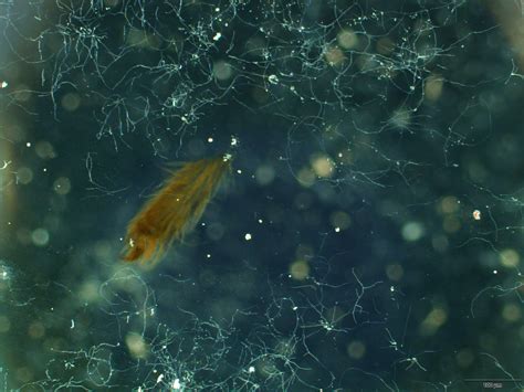 Image result for Microscope Toes