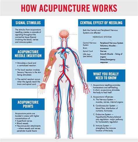 Acupuncture 的图像结果