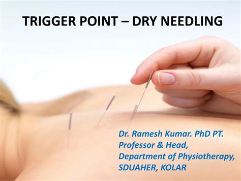 basics in dry needling and trigger points | PPTX