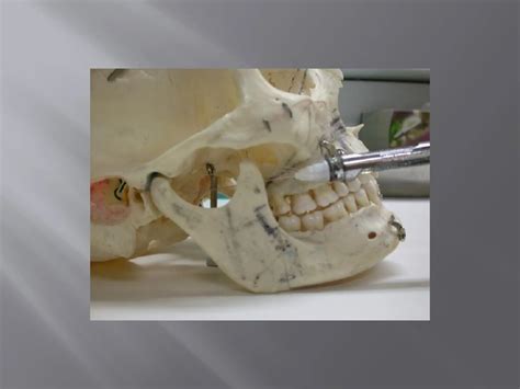 Local Anesthesia Types 的图像结果