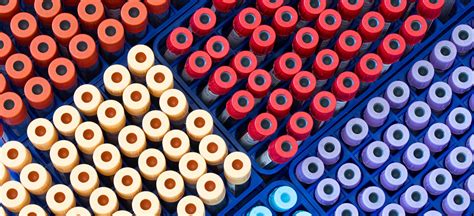 Image result for Covid Testing Examples