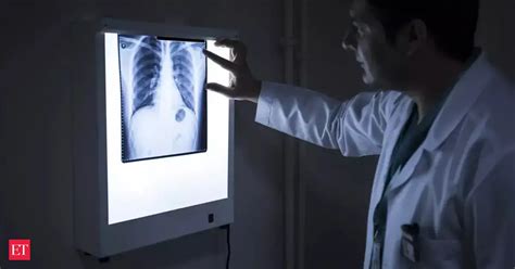 covid 19: New AI-based test uses X-rays to detect COVID-19 in few ...