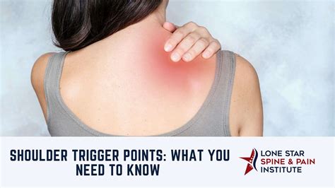 Shoulder Trigger Points: What You Need to Know