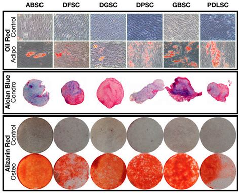 Expression of Musashi-1 During Osteogenic Differentiation of Oral MSC ...