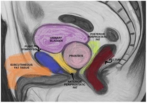Bioengineering | Special Issue : Label-Free Cancer Detection