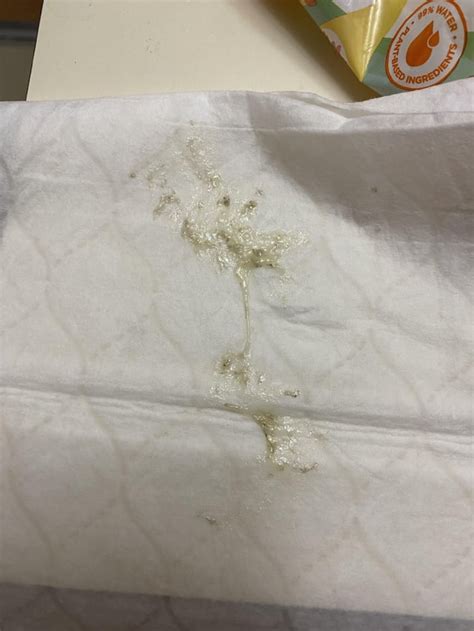 Smoker Coughing Up Brown Specks at Valeria Sturm blog