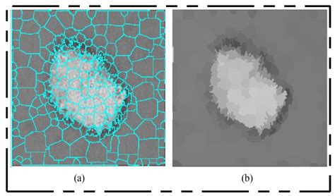 Skin Lesion Segmentation and Multiclass Classification Using Deep ...