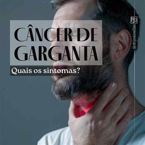 Quais os Sintomas do Câncer de Garganta? Os 8 principais! | Dr João Elias