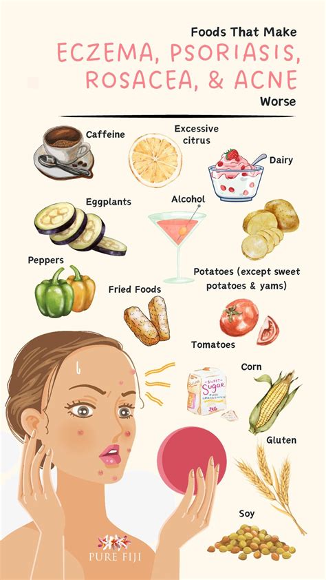 The ultimate guide to a diet for eczema foods to eat and avoid – Artofit