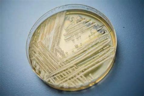 “耳念珠菌”在美国蔓延，国内感染情况如何？-行业动态-江苏慧谷生物技术有限公司官网